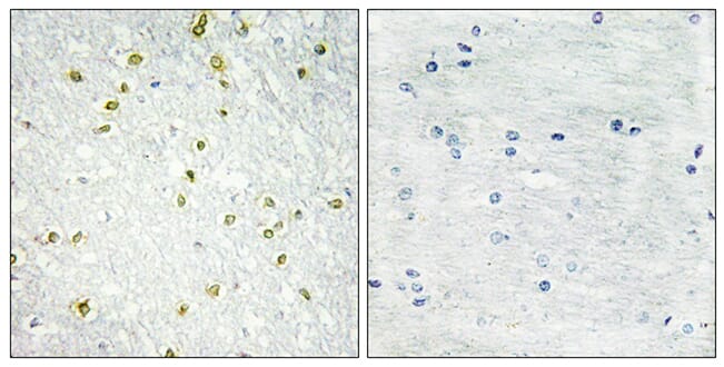 Immunohistochemical analysis of paraffin-embedded human brain tissue using Anti-SNAPC5 Antibody. The right hand panel represents a negative control, where the antibody was pre-incubated with the immunising peptide.