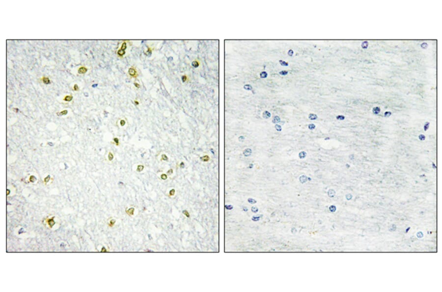 Immunohistochemistry - Anti-SNAPC5 Antibody (C10201) - Antibodies.com