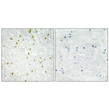 Immunohistochemistry - Anti-SNAPC5 Antibody (C10201) - Antibodies.com