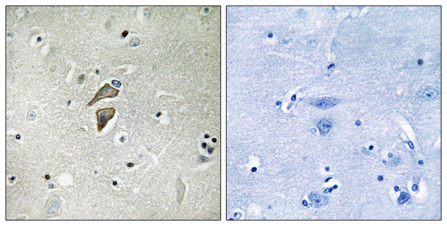 Immunohistochemical analysis of paraffin-embedded human brain tissue using Anti-RNF149 Antibody. The right hand panel represents a negative control, where the antibody was pre-incubated with the immunising peptide.