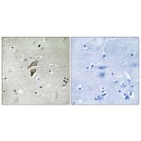 Immunohistochemistry - Anti-RNF149 Antibody (C15576) - Antibodies.com