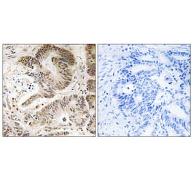 Immunohistochemistry - Anti-PIK3R5 Antibody (C17707) - Antibodies.com