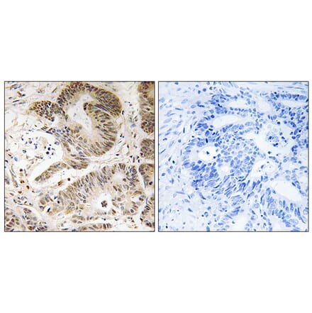 Immunohistochemistry - Anti-PIK3R5 Antibody (C17707) - Antibodies.com