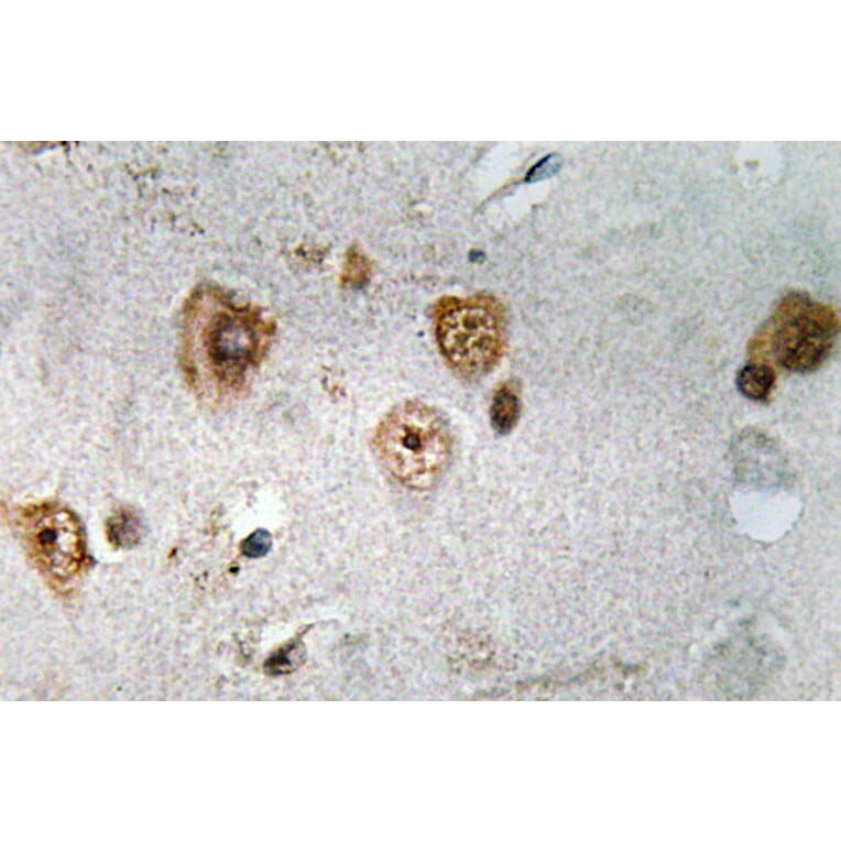 Immunohistochemistry - Anti-NCoA-3 Antibody (R12-2253) - Antibodies.com