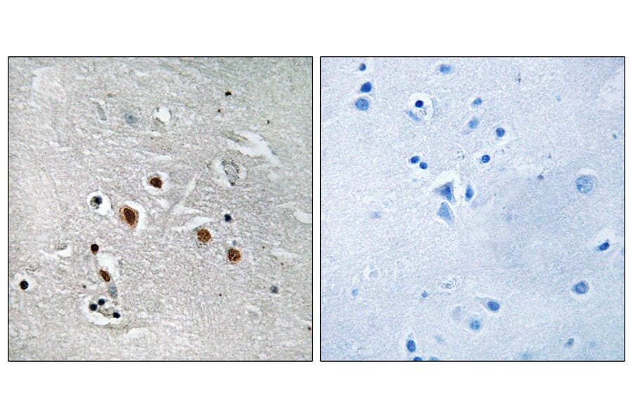 Immunohistochemistry - Anti-MED13L Antibody (C16573) - Antibodies.com
