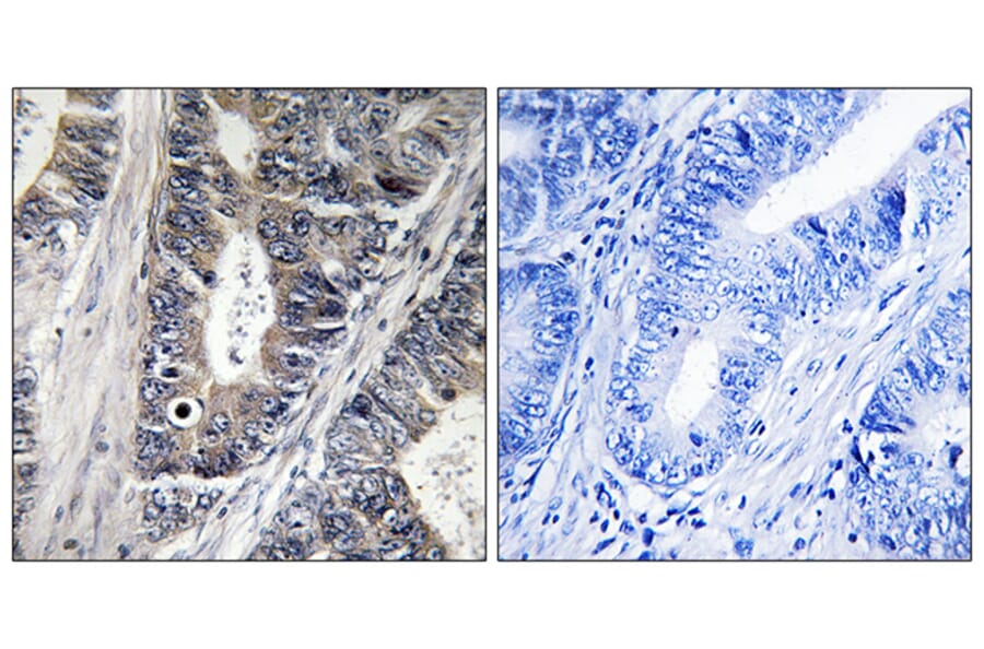 Immunohistochemistry - Anti-MAP3K9 Antibody (C10801) - Antibodies.com
