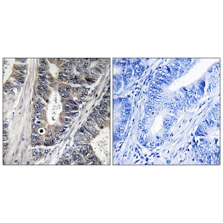 Immunohistochemistry - Anti-MAP3K9 Antibody (C10801) - Antibodies.com