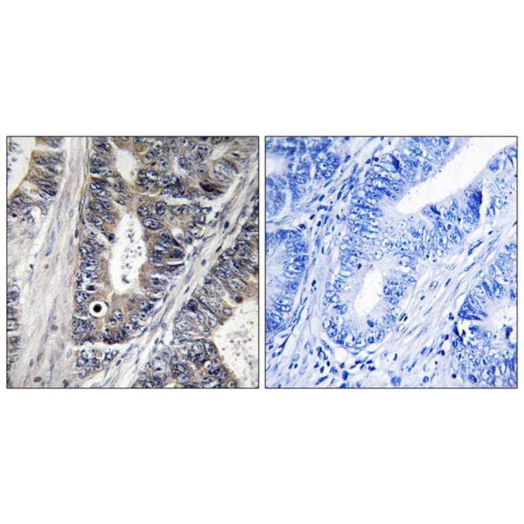 Immunohistochemistry - Anti-MAP3K9 Antibody (C10801) - Antibodies.com