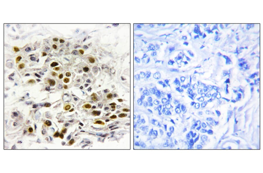 Immunohistochemistry - Anti-MAP3K6 Antibody (C10227) - Antibodies.com