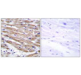 Immunohistochemistry - Anti-MAP3K4 Antibody (C11995) - Antibodies.com