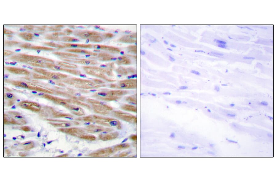 Immunohistochemistry - Anti-MAP3K4 Antibody (C11995) - Antibodies.com