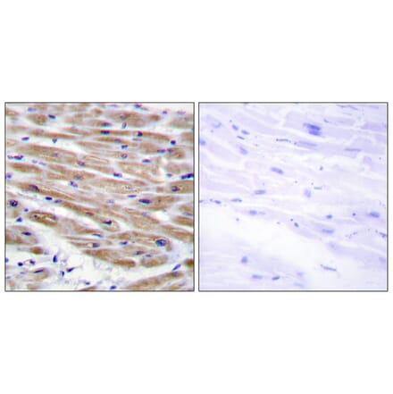 Immunohistochemistry - Anti-MAP3K4 Antibody (C11995) - Antibodies.com