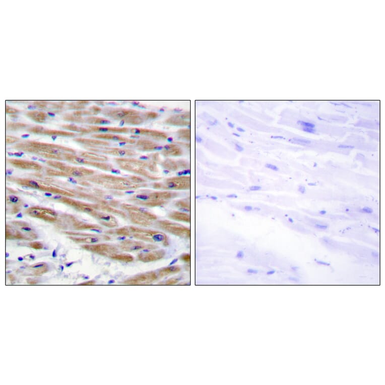 Immunohistochemistry - Anti-MAP3K4 Antibody (C11995) - Antibodies.com