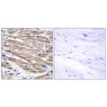 Immunohistochemistry - Anti-MAP3K4 Antibody (C11995) - Antibodies.com