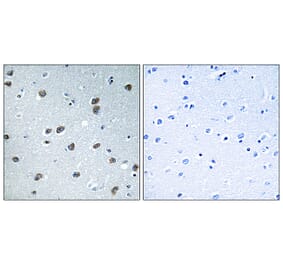 Immunohistochemistry - Anti-KLHL29 Antibody (C16417) - Antibodies.com