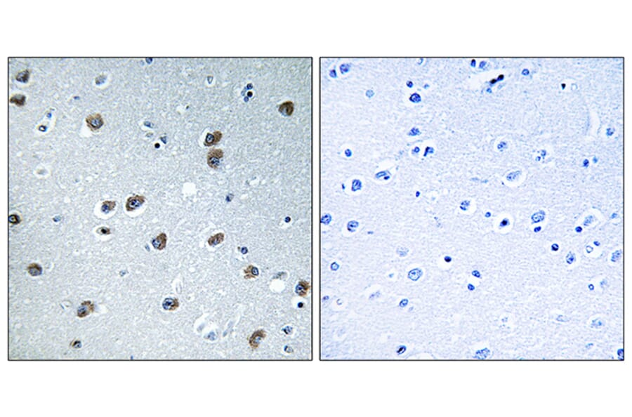 Immunohistochemistry - Anti-KLHL29 Antibody (C16417) - Antibodies.com