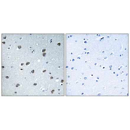 Immunohistochemistry - Anti-KLHL29 Antibody (C16417) - Antibodies.com
