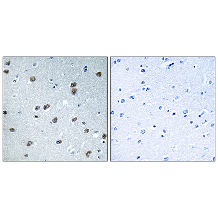 Immunohistochemistry - Anti-KLHL29 Antibody (C16417) - Antibodies.com
