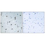 Immunohistochemistry - Anti-KLHL29 Antibody (C16417) - Antibodies.com