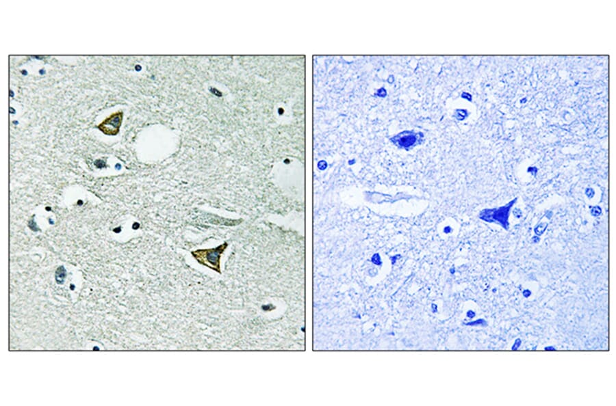 Immunohistochemistry - Anti-Girdin Antibody (B8352) - Antibodies.com