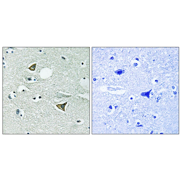Immunohistochemistry - Anti-Girdin Antibody (B8352) - Antibodies.com