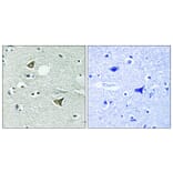 Immunohistochemistry - Anti-Girdin Antibody (B8352) - Antibodies.com