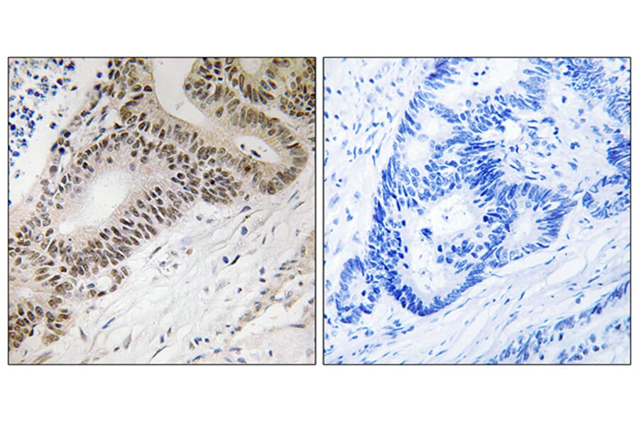 Immunohistochemistry - Anti-FOXO3A Antibody (B8034) - Antibodies.com