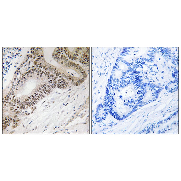 Immunohistochemistry - Anti-FOXO3A Antibody (B8034) - Antibodies.com