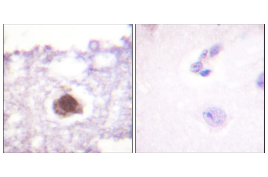 Immunohistochemistry - Anti-DNA-PK Antibody (B0909) - Antibodies.com