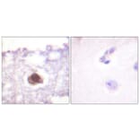 Immunohistochemistry - Anti-DNA-PK Antibody (B0909) - Antibodies.com