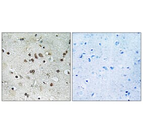 Immunohistochemistry - Anti-BTF3L4 Antibody (C19189) - Antibodies.com