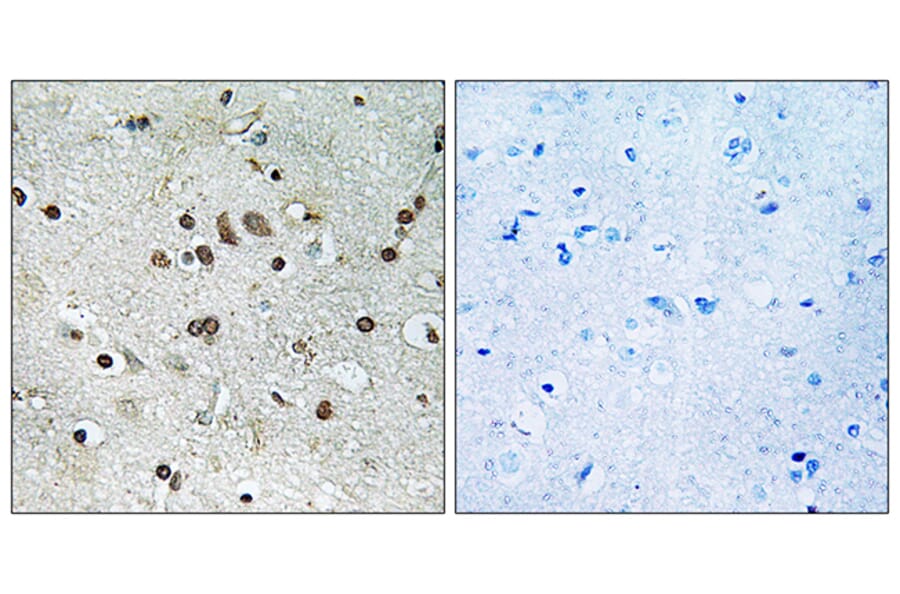 Immunohistochemistry - Anti-BTF3L4 Antibody (C19189) - Antibodies.com