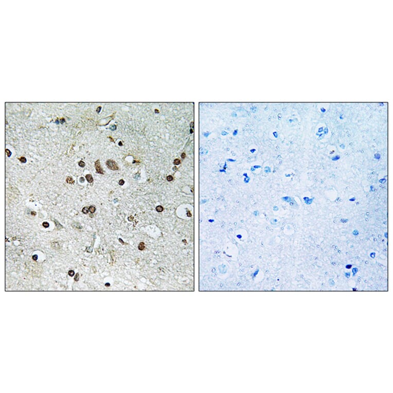 Immunohistochemistry - Anti-BTF3L4 Antibody (C19189) - Antibodies.com