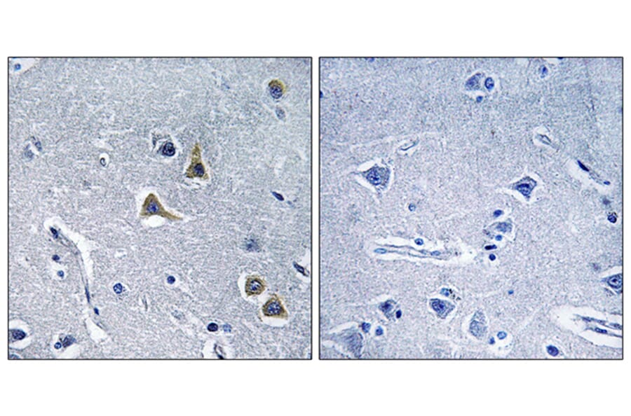 Immunohistochemistry - Anti-ARRDC2 Antibody (C12060) - Antibodies.com