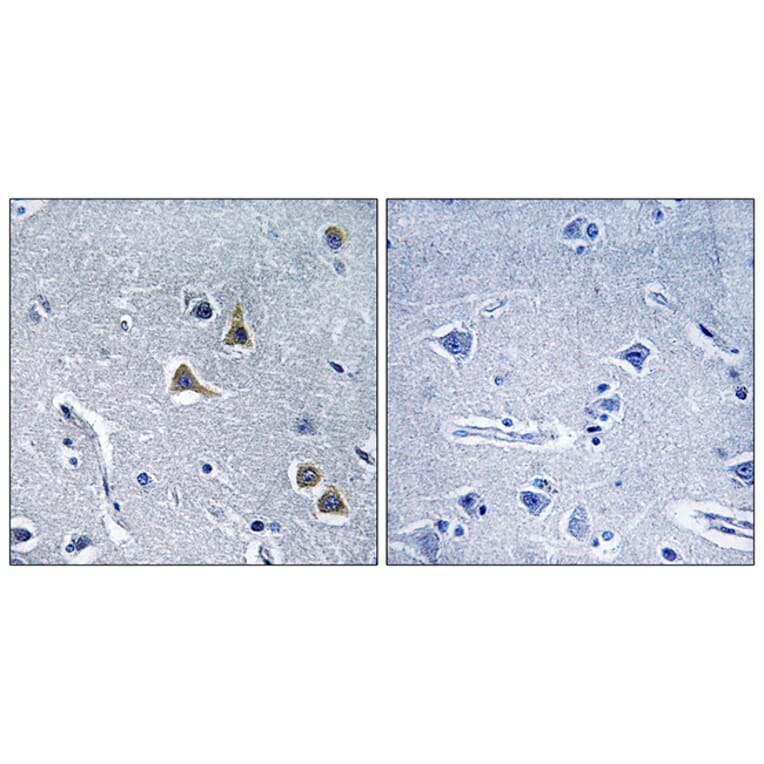 Immunohistochemistry - Anti-ARRDC2 Antibody (C12060) - Antibodies.com