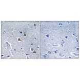Immunohistochemistry - Anti-ARRDC2 Antibody (C12060) - Antibodies.com