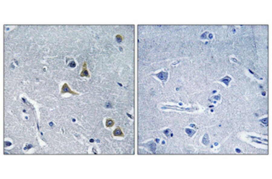 Immunohistochemistry - Anti-ARRDC2 Antibody (C12060) - Antibodies.com