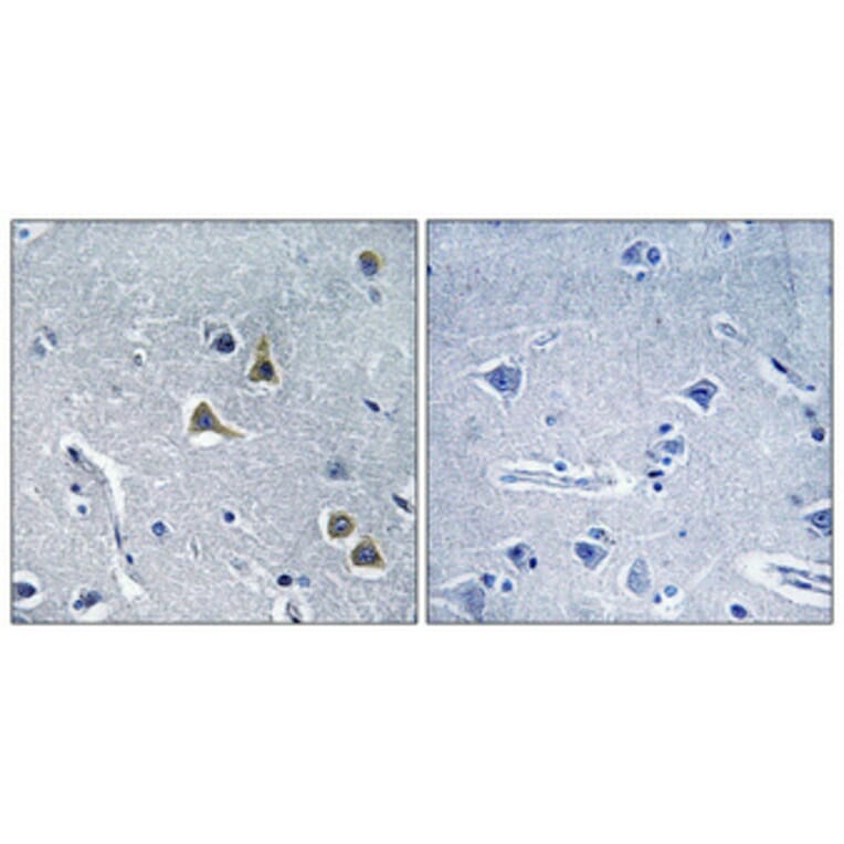 Immunohistochemistry - Anti-ARRDC2 Antibody (C12060) - Antibodies.com