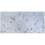 Immunohistochemistry - Anti-ARRDC2 Antibody (C12060) - Antibodies.com