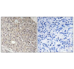 Immunohistochemistry - Anti-AMOTL1 Antibody (C14473) - Antibodies.com