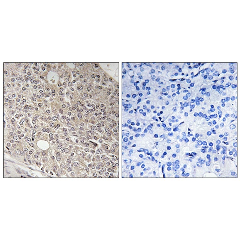 Immunohistochemistry - Anti-AMOTL1 Antibody (C14473) - Antibodies.com