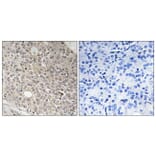 Immunohistochemistry - Anti-AMOTL1 Antibody (C14473) - Antibodies.com