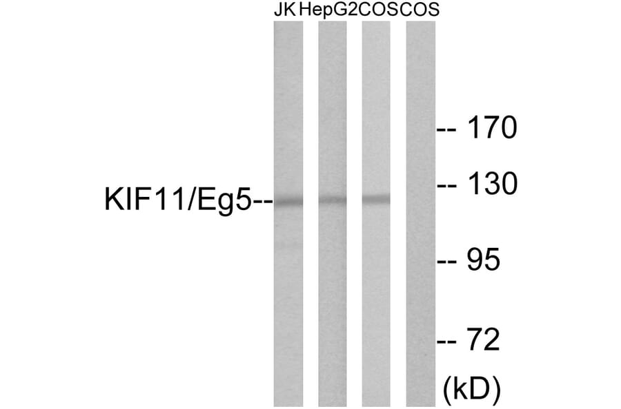 Western Blot - Anti-KIF11 Antibody (B1081) - Antibodies.com