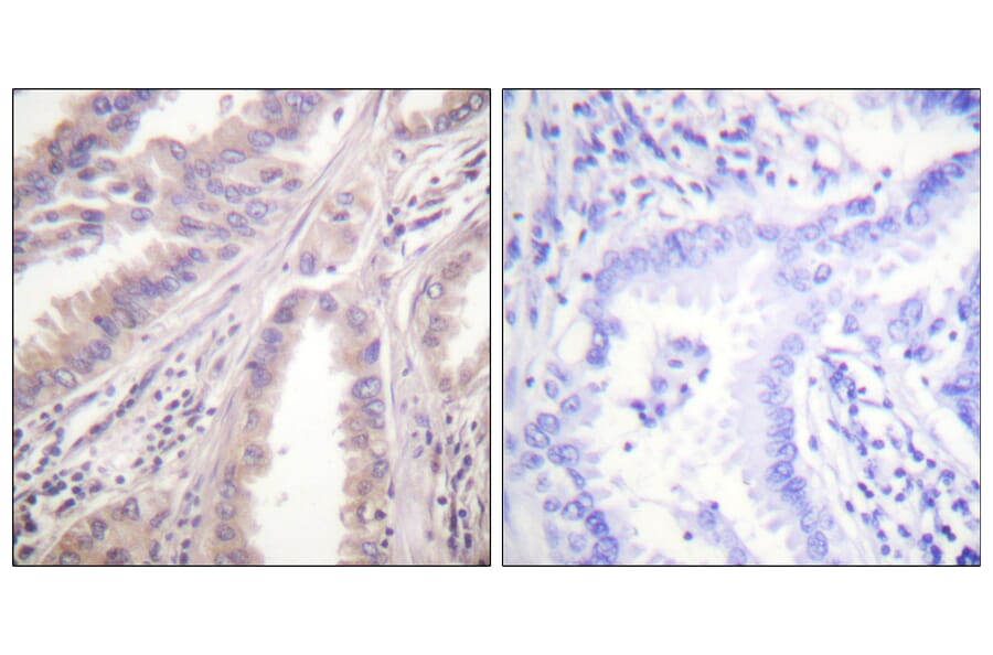 Immunohistochemistry - Anti-KIF11 Antibody (B1081) - Antibodies.com