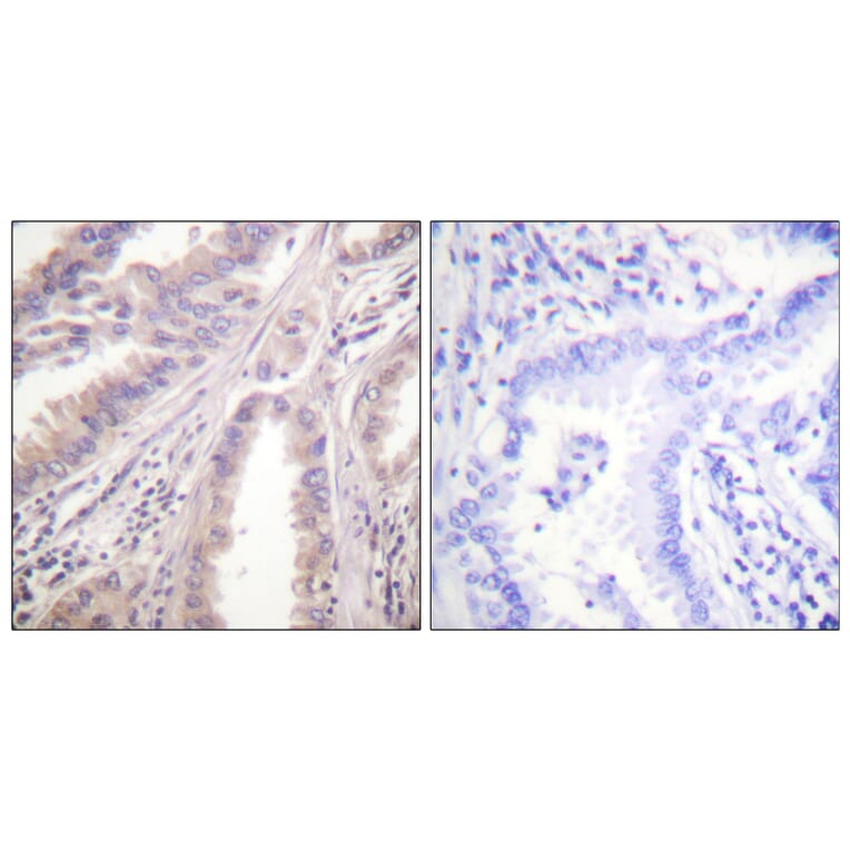 Immunohistochemistry - Anti-KIF11 Antibody (B1081) - Antibodies.com