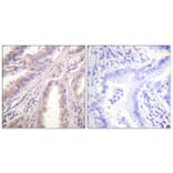 Immunohistochemistry - Anti-KIF11 Antibody (B1081) - Antibodies.com