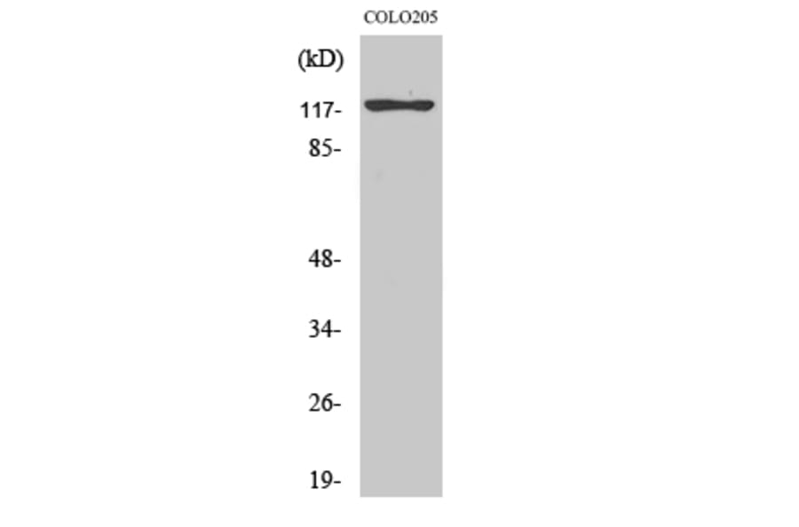 Western Blot - Anti-KIF11 Antibody (B1081) - Antibodies.com
