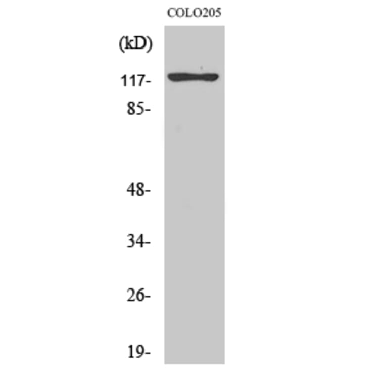 Western Blot - Anti-KIF11 Antibody (B1081) - Antibodies.com