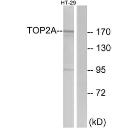 Western Blot - Anti-TOP2A Antibody (C10345) - Antibodies.com