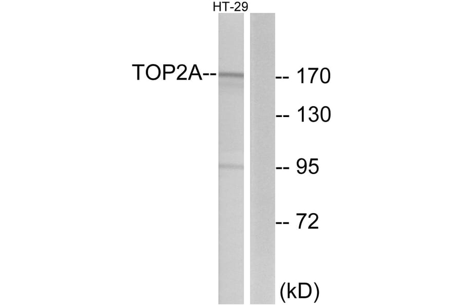 Western Blot - Anti-TOP2A Antibody (C10345) - Antibodies.com